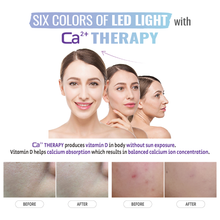 Load image into Gallery viewer, Cellaxy Aurora 7-in-1 PDT LED Light Therapy System
