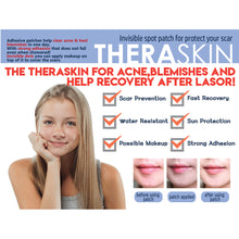 Load image into Gallery viewer, THERASKIN Acne Spot Treatment Pimple Patches Hydrocolloid (12mm/120pcs)
