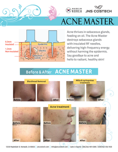 Acne Master (Acne & Pimple Treatment)