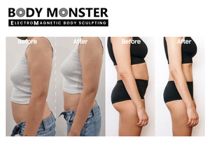 [NEW] BODY MONSTER (Electro Magnetic Body Sculpting)